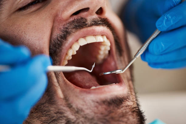 Emergency Gum Pain Relief in AK